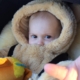 Eczema in babies